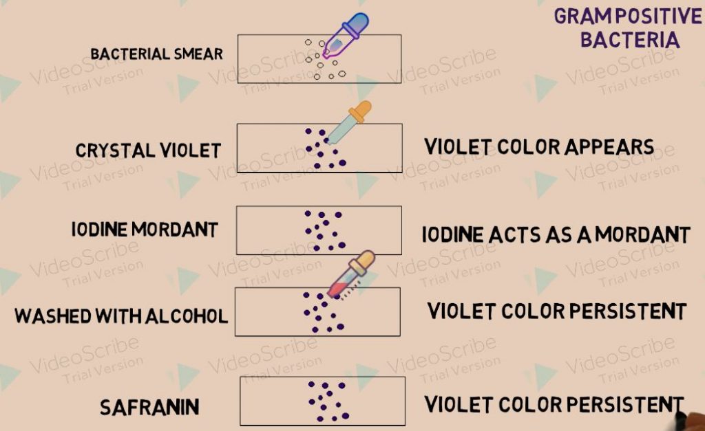 STAINING Principle, Reagents, Procedure, Steps, Results Interpretation ...